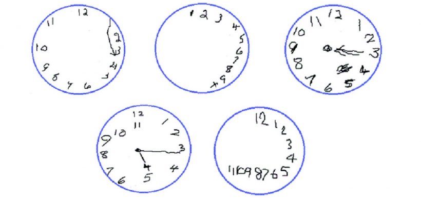 EVALUACIÓN DE LA UTILIDAD DIAGNÓSTICA Y VALIDEZ DISCRIMINATIVA DEL TEST DEL RELOJ Y DEL MINI-COG EN LA DETECCIÓN DEL DETERIORO COGNITIVO